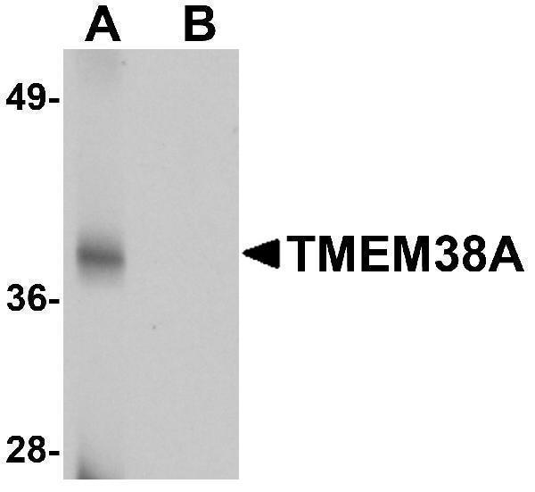 Western blot analysis of TMEM38A in rat skeletal muscle tissue lysate with TMEM38A antibody at 1 μg/mL in (A) the absence and (B) the presence of blocking peptide