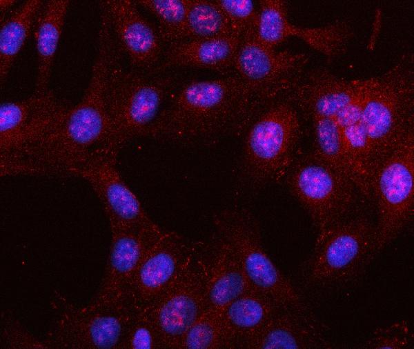 Figure 5. IF analysis of LRRN4 using anti-LRRN4 antibody (A15151-2). LRRN4 was detected in an immunocytochemical section of U2OS cells. Enzyme antigen retrieval was performed using IHC enzyme antigen retrieval reagent (AR0022) for 15 mins. The cells were blocked with 10% goat serum. And then incubated with 5 microg/mL rabbit anti-LRRN4 Antibody (A15151-2) overnight at 4°C. Cy3 Conjugated Goat Anti-Rabbit IgG (BA1032) was used as secondary antibody at 1:500 dilution and incubated for 30 minutes at 37°C. The section was counterstained with DAPI. Visualize using a fluorescence microscope and filter sets appropriate for the label used.