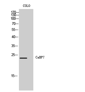 Western Blot analysis of COLO cells using CaBP7 Polyclonal Antibody diluted at 1:1000