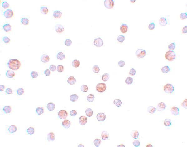 Immunocytochemistry of CaBP7 in HeLa cells with CaBP7 antibody at 4 μg/mL