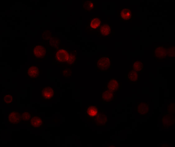 Immunofluorescence of CABP7 in HeLa cells with CAPB7 antibody at 20 μg/mL