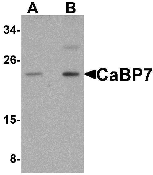 Western blot analysis of CaBP7 in Hela cell lysate with CaBP7 antibody at (A) 1 and (B) 2 μg/mL