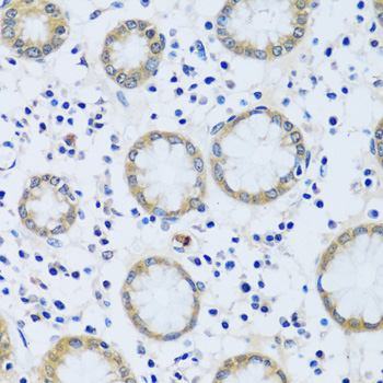 Immunohistochemistry of paraffin-embedded human stomach using CABP7 antibody  at dilution of 1:100 