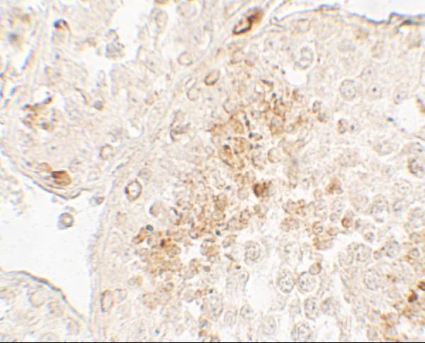 Immunohistochemistry of GLIPR1L1 in human testis tissue with GLIPR1L1 antibody at 5 μg/mL