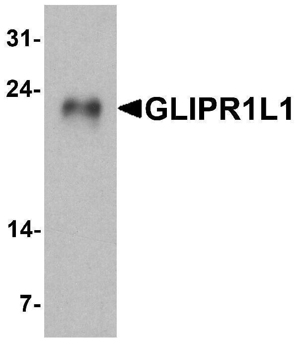 Western blot analysis of GLIPR1L1 in human testis tissue lysate with GLIPR1L1 antibody at 1 μg/ml