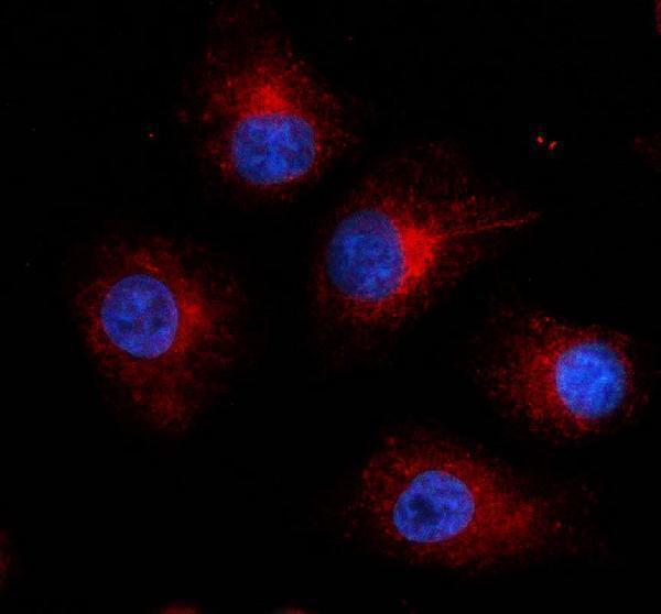 IF analysis of RPL22L1 using anti-RPL22L1 antibody (A15161-2)