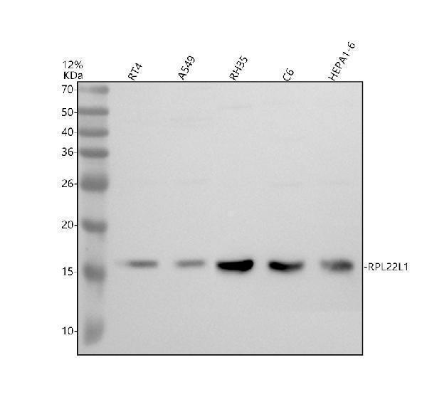 Western blot analysis of RPL22L1 using anti-RPL22L1 antibody (A15161-2)