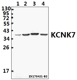 a15165 1 kcnk7 primary antiboties wb testing 1