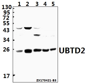 Western blot (WB) analysis of UBTD2 polyclonal antibody at 1:500 dilution
Lane1:SGC7901 whole cell lysate(40ug)
Lane2:HepG2 whole cell lysate(40ug)
Lane3:A549 whole cell lysate(40ug)
Lane4:CT26 whole cell lysate(40ug)
Lane5:PC12 whole cell lysate(40ug)
