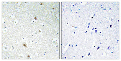 a15179 foxr1 primary antibodies ihc testing 1