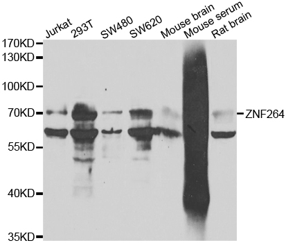 Western blot analysis of extracts of various cell lines, using ZNF264 antibody