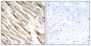 Immunohistochemical analysis of paraffin-embedded Human heart
