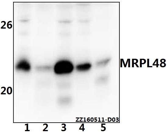 Western blot (WB) analysis of MRPL48 polyclonal antibody at 1:500 dilution
Lane1:THP-1 whole cell lysate(40ug)
Lane2:Hela whole cell lysate(40ug)
Lane3:HEK293T whole cell lysate(40ug)
Lane4:PC12 whole cell lysate(40ug)
Lane5:AML-12 whole cell lysate(40ug)