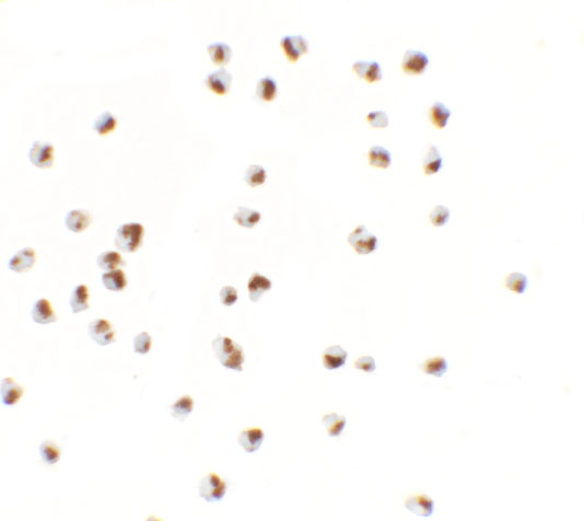 Immunocytochemistry of YPEL5 in A20 cells with YPEL5 antibody at 2