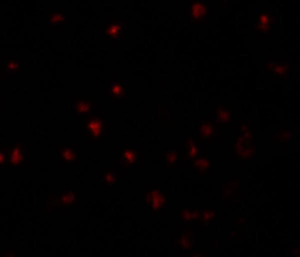 Immunofluorescence of YPEL5 in A20 cells with YPEL5 antibody at 5 μg/mL