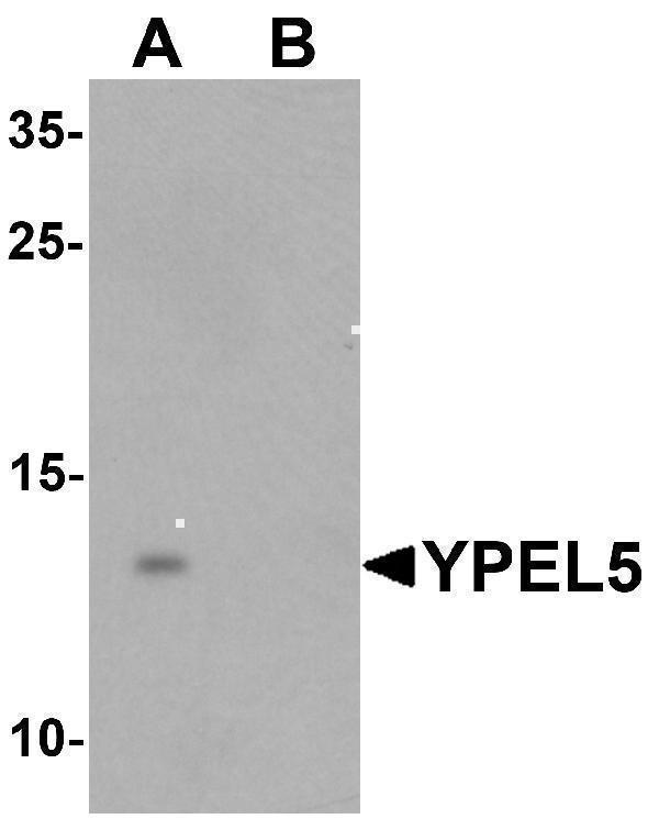 Western blot analysis of YPEL5 in A-20 cell lysate with YPEL5 antibody at 1 μg/mL in (A) the absence and (B) the presence of blocking peptide
