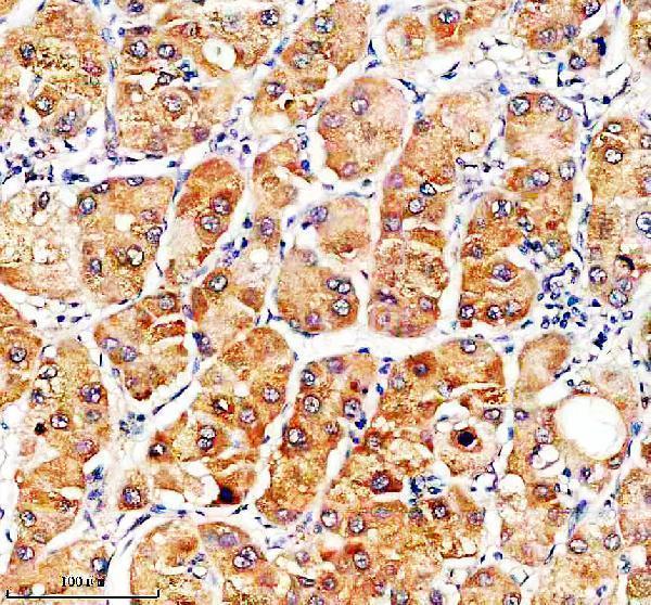 a15198 2 slc46a3 primary antibodies ihc testing 1