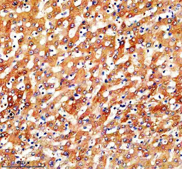 a15198 2 slc46a3 primary antibodies ihc testing 2