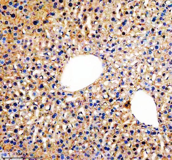 a15198 2 slc46a3 primary antibodies ihc testing 3