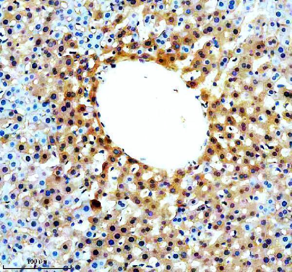 a15198 2 slc46a3 primary antibodies ihc testing 4