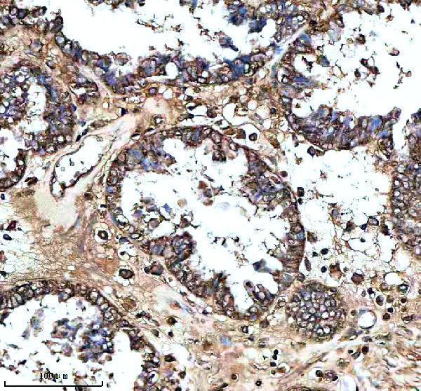 IHC analysis of MS4A4E using anti-MS4A4E antibody (A15220)