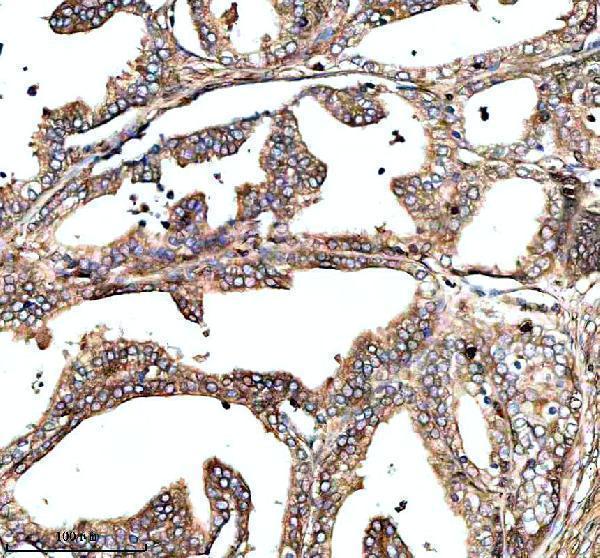 IHC analysis of MS4A4E using anti-MS4A4E antibody (A15220)