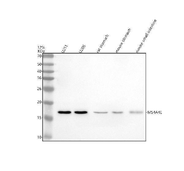 Western blot analysis of MS4A4E using anti-MS4A4E antibody (A15220)