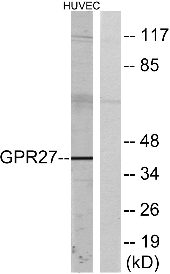 Western blot analysis of lysates from HUVEC cells, using GPR27 Antibody
