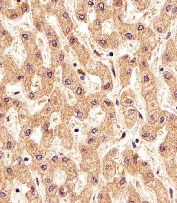 Immunohistochemical analysis of paraffin-embedded H. liver section using PSMAL Antibody (Center). A15227-1 was diluted at 1:25 dilution. A undiluted biotinylated goat polyvalent antibody was used as the secondary, followed by DAB staining.