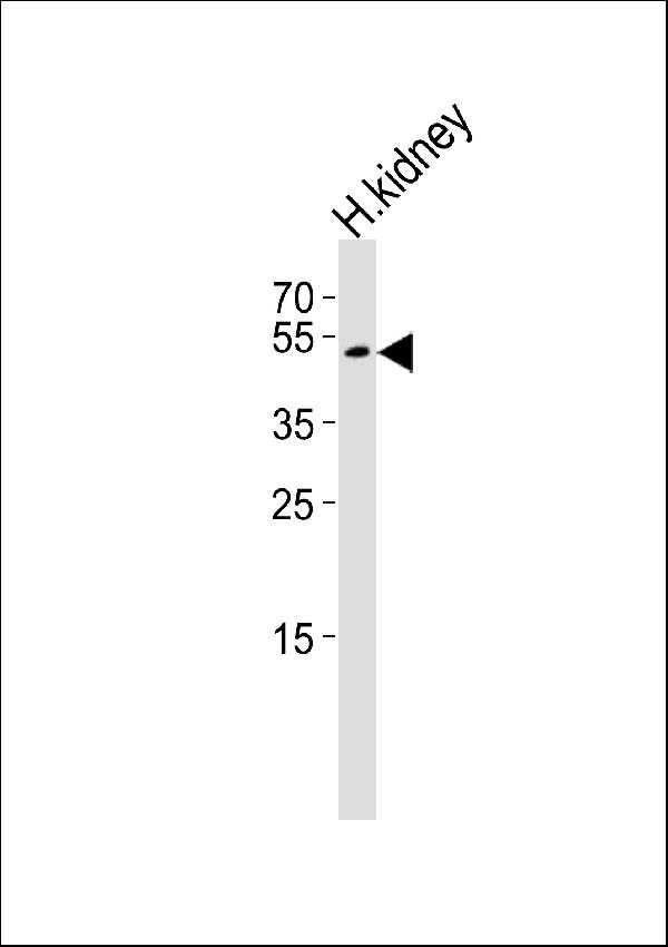 Western blot analysis of lysate from human kidney tissue lysate, using PSMAL Antibody (Center). A15227-1 was diluted at 1:1000. A goat anti-rabbit IgG H&L (HRP) at 1:10000 dilution was used as the secondary antibody. Lysate at 35ug.