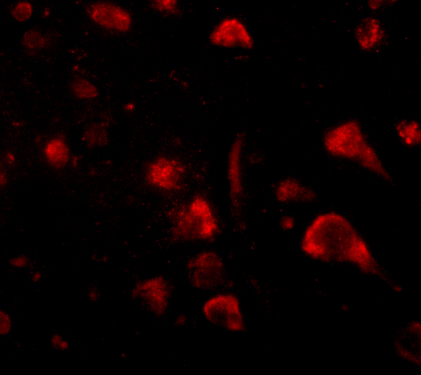 Immunofluorescence of spred3 in human brain tissue with spred3 antibody at 20 μg/mL
