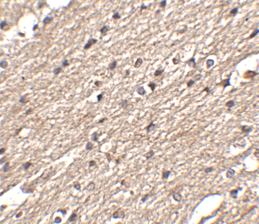 Immunohistochemistry of Spred3 in human brain tissue with Spred3 antibody at 2