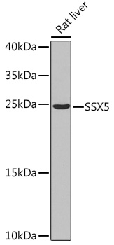 a15233 ssx5 primary antiboties wb testing 1