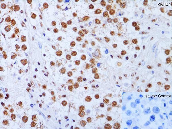  Immunohistochemistry Validation of RKHD4 in Human Testis  
Immunohistochemical analysis of paraffin-embedded human testis tissue using anti-RKHD4 antibody (A15239) at 1 μg/ml