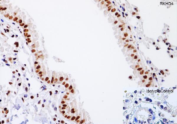  Immunohistochemistry Validation of RKHD4 in Mouse lung  
Immunohistochemical analysis of paraffin-embedded mouse lung tissue using anti-RKHD4 antibody (A15239) at 1 μg/ml