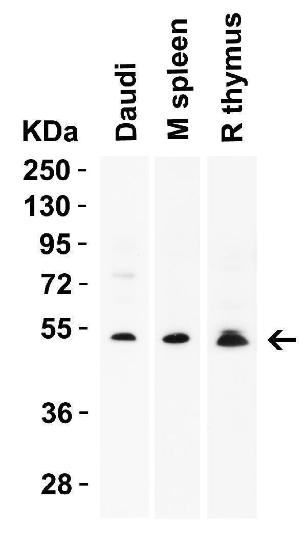  WB Validation  in Human, Mouse and Rat Samples
Loading: 15 μg of lysate 
Antibodies:  RKHD4, A15239, 2 μ g/mL, 1 h incubation at RT in 5% NFDM/TBST