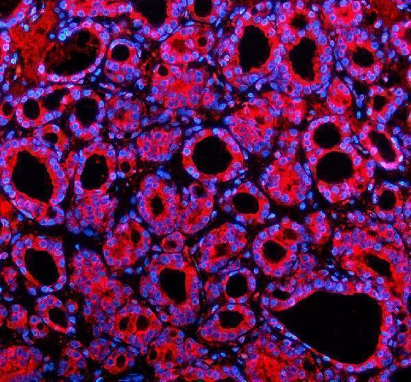 a15256 1 she primary antibodies if testing 1