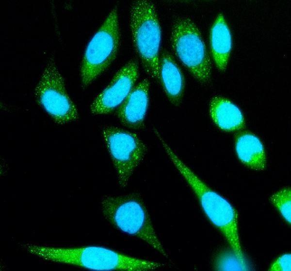 a15256 1 she primary antibodies if testing 2