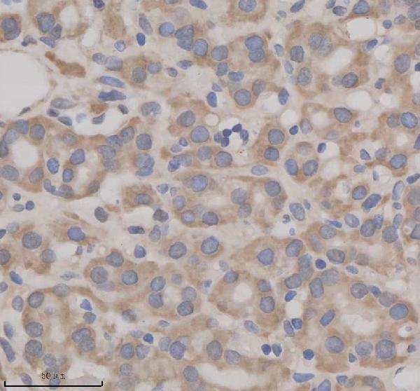 IHC analysis of SHE using anti-SHE antibody (A15256-1)