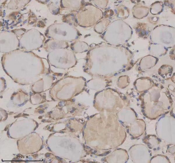 IHC analysis of SHE using anti-SHE antibody (A15256-1)