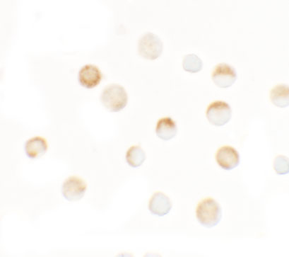 a15258 slc35d3 primary antibodies icc testing 2