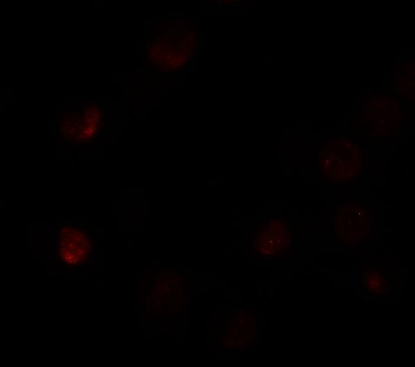 a15258 slc35d3 primary antibodies if testing 3