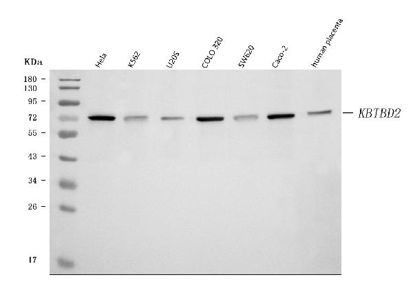 Figure 1. Western blot analysis of KBTBD2 using anti-KBTBD2 antibody (A15277-1). Electrophoresis was performed on a 5-20% SDS-PAGE gel at 70V (Stacking gel) / 90V (Resolving gel) for 2-3 hours. The sample well of each lane was loaded with 30 ug of sample under reducing conditions. Lane 1: human Hela whole cell lysates, Lane 2: human K562 whole cell lysates, Lane 3: human U20S whole cell lysates, Lane 4: human COLO320 whole cell lysates, Lane 5: human SW620 whole cell lysates, Lane 6: human Caco-2 whole cell lysates, Lane 7: human placenta tissue lysates. After electrophoresis, proteins were transferred to a nitrocellulose membrane at 150 mA for 50-90 minutes. Blocked the membrane with 5% non-fat milk/TBS for 1.5 hour at RT. The membrane was incubated with rabbit anti-KBTBD2 antigen affinity purified polyclonal antibody (Catalog # A15277-1) at 0.5 microg/mL overnight at 4°C, then washed with TBS-0.1%Tween 3 times with 5 minutes each and probed with a goat anti-rabbit IgG-HRP secondary antibody at a dilution of 1:5000 for 1.5 hour at RT. The signal is developed using an Enhanced Chemiluminescent detection (ECL) kit (Catalog # EK1002) with Tanon 5200 system. A specific band was detected for KBTBD2 at approximately 72 kDa. The expected band size for KBTBD2 is at 71 kDa.
