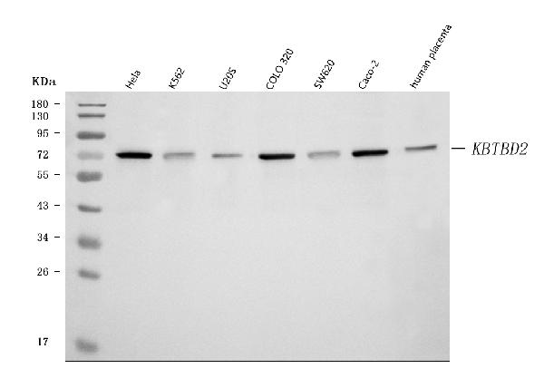 Western blot analysis of KBTBD2 using anti-KBTBD2 antibody (A15277-1).