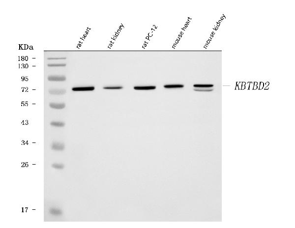 Figure 2. Western blot analysis of KBTBD2 using anti-KBTBD2 antibody (A15277-1). Electrophoresis was performed on a 5-20% SDS-PAGE gel at 70V (Stacking gel) / 90V (Resolving gel) for 2-3 hours. The sample well of each lane was loaded with 30 ug of sample under reducing conditions. Lane 1: rat heart tissue lysates, Lane 2: rat kidney tissue lysates, Lane 3: rat PC-12 whole cell lysates, Lane 4: mouse heart tissue lysates, Lane 5: mouse kidney tissue lysates. After electrophoresis, proteins were transferred to a nitrocellulose membrane at 150 mA for 50-90 minutes. Blocked the membrane with 5% non-fat milk/TBS for 1.5 hour at RT. The membrane was incubated with rabbit anti-KBTBD2 antigen affinity purified polyclonal antibody (Catalog # A15277-1) at 0.5 microg/mL overnight at 4°C, then washed with TBS-0.1%Tween 3 times with 5 minutes each and probed with a goat anti-rabbit IgG-HRP secondary antibody at a dilution of 1:5000 for 1.5 hour at RT. The signal is developed using an Enhanced Chemiluminescent detection (ECL) kit (Catalog # EK1002) with Tanon 5200 system. A specific band was detected for KBTBD2 at approximately 72 kDa. The expected band size for KBTBD2 is at 71 kDa.