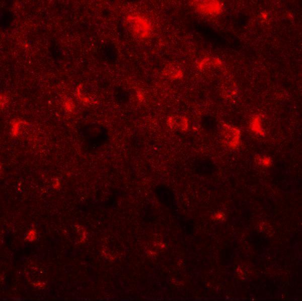 a15285 tmem59l primary antibodies if testing 3