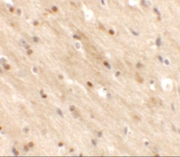 a15285 tmem59l primary antibodies ihc testing 2