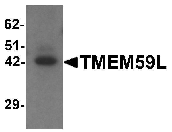 a15285 tmem59l primary antibodies wb testing 1
