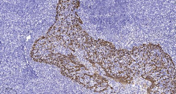 a15287 gpr135 primary antibodies ihc testing 1