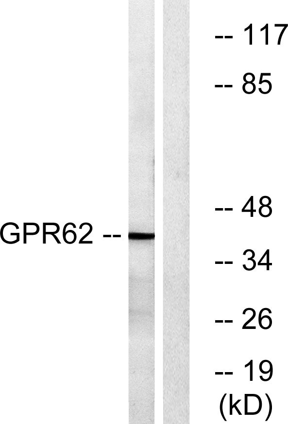 Western blot analysis of lysates from COLO cells, using GPR62 Antibody